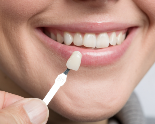 10-1536×1024 10-1536x1024