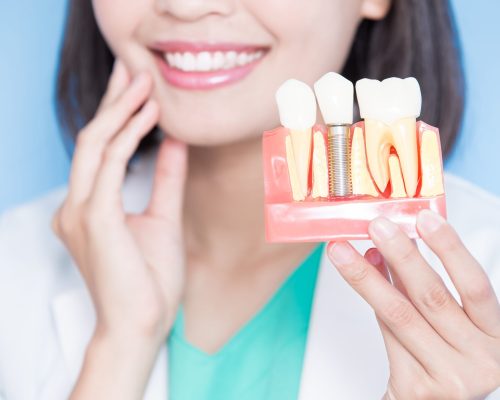 woman dentist take implant tooth and touch tooth on the blue background