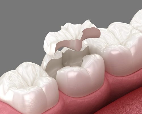 AdobeStock_521975583-scaled AdobeStock_521975583-scaled